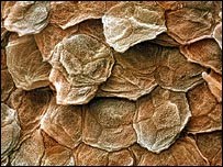 Descamaci&oacute;n de la Piel Canina