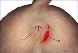 Las Gl&aacute;ndulas Anales